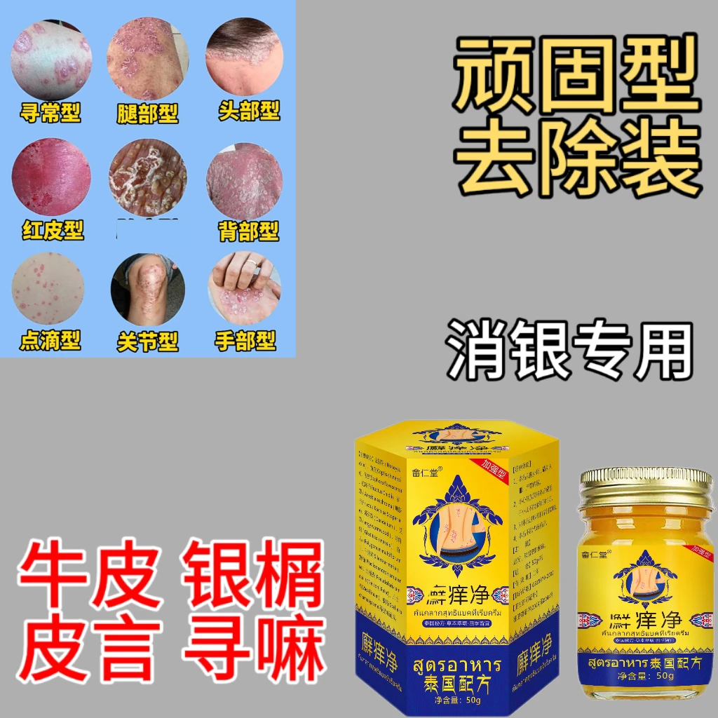 皮肤干燥王草本仰菌奇痒护理脚痒手部水泡脱皮止痒小乳膏涂抹外用