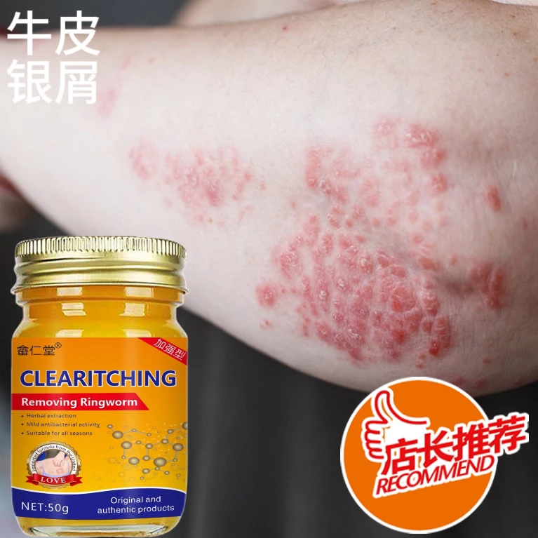 身上皮肤止痒膏皮肤痒百草百消膏蚊虫叮咬顽痒清草本止痒克星断痒