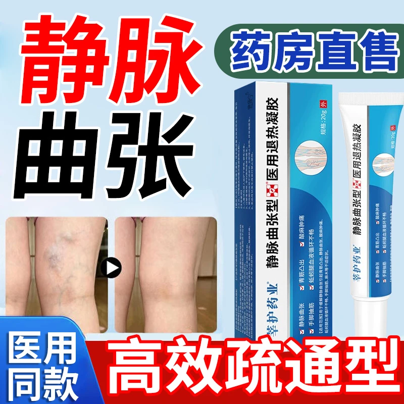 静脉曲张医用退热凝胶发热肿胀青筋凸起蚯蚓腿疼痛腿部酸痛雅康宁