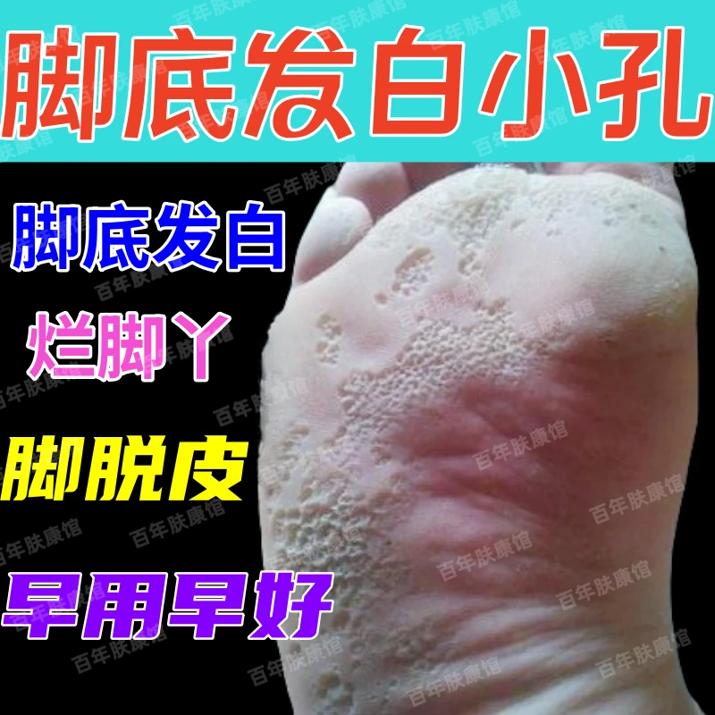 脚底起皮发白蜂窝状小孔脚趾缝脱皮开裂烂脚丫脚痒发白脚臭抑菌膏