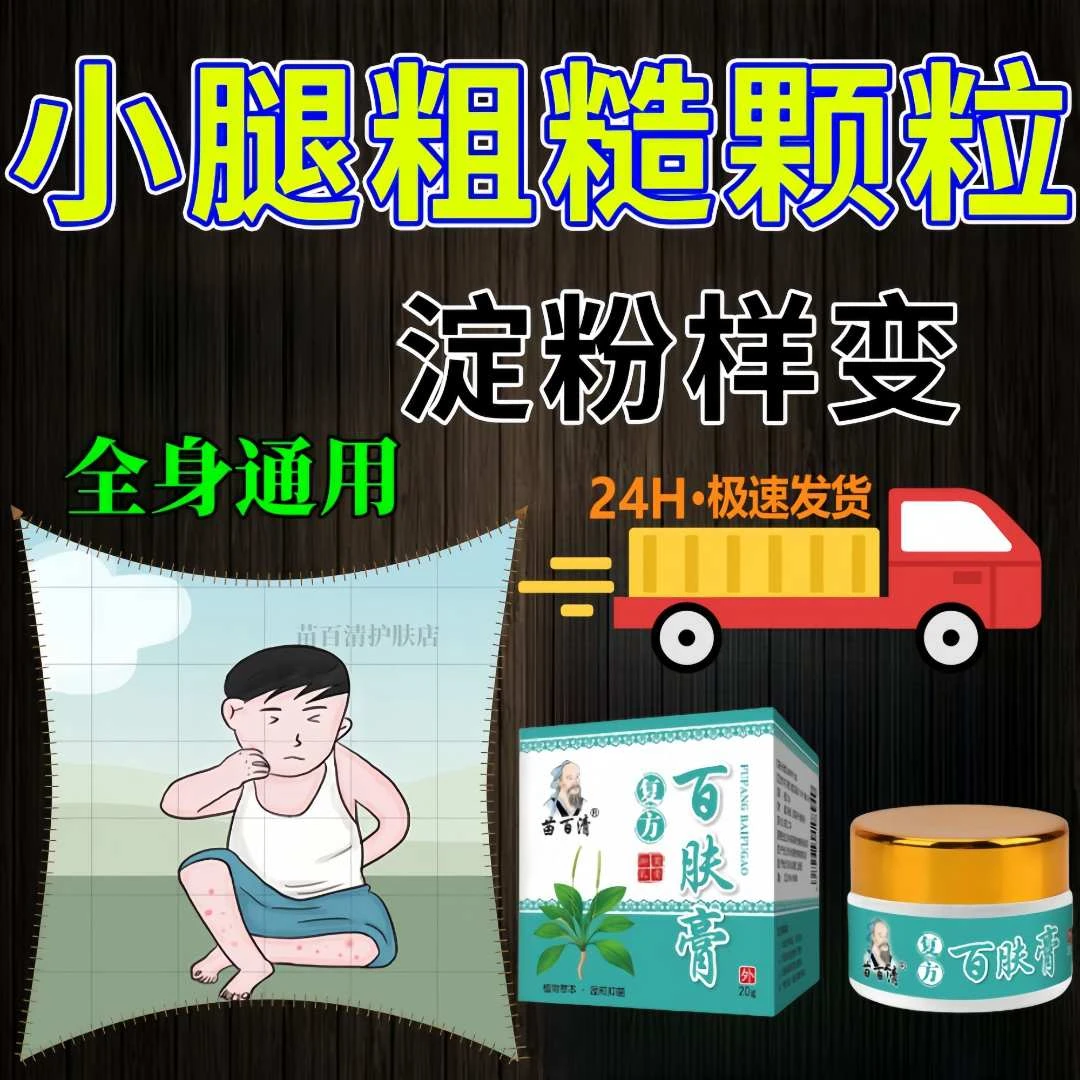 皮肤淀粉样变粗糙沉积成人老人儿童外用乳膏皮肤身体通用草本乳膏