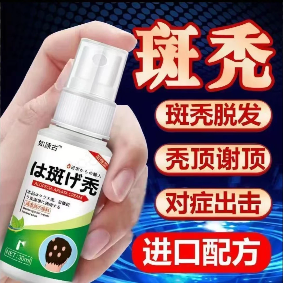斑秃鬼剃头生发液严重掉发秃顶突发性斑秃非瘢痕性突发成片脱