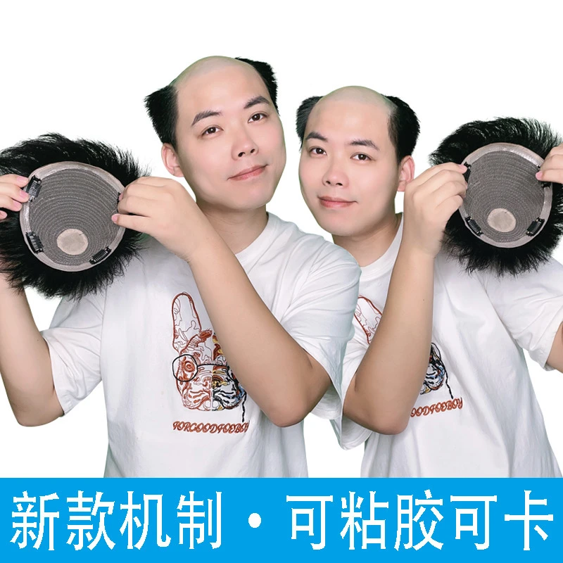 (机制款可粘胶可用卡)假发男士真发补发片男补发块机制可粘胶卡