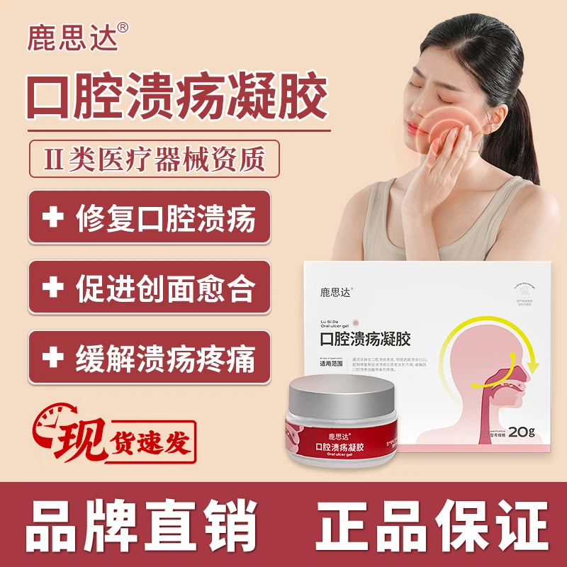 鹿思达口腔溃疡凝胶缓解口腔溃疡创面带来的疼痛促进溃疡创面愈合