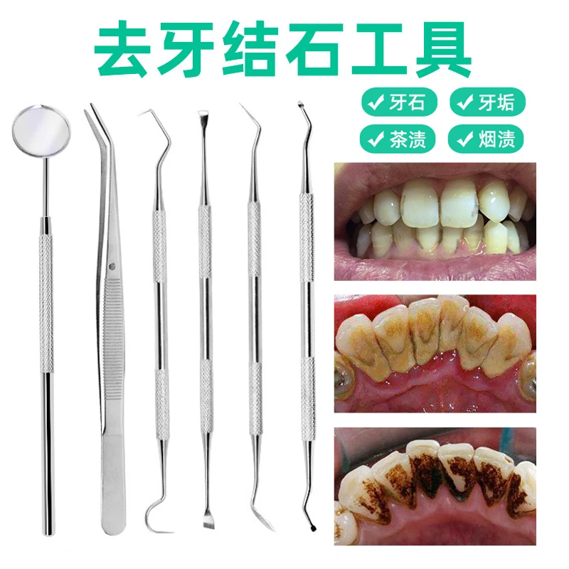 牙结石工具家用去牙垢去牙结石清理神器抠牙垢牙结石脱落洁牙剔牙