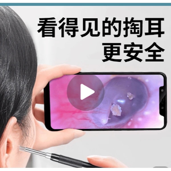 可视掏耳勺家用掏耳神器挖耳勺采耳工具掏耳朵发光掏可视采耳勺