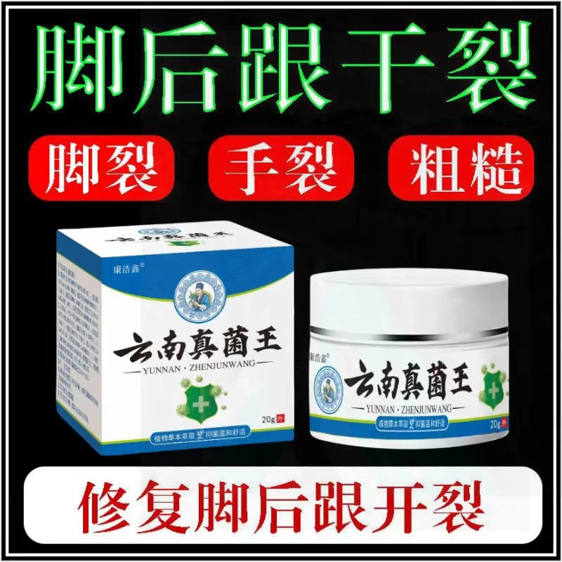 正品云南真菌王脚后跟起皮粗糙干裂起硬皮手开口干裂防裂膏