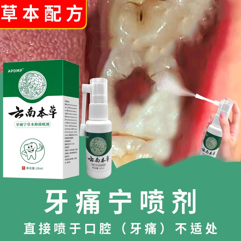 牙齿痛牙疼牙痛喷雾剂云南本草牙痛宁草本抑菌喷剂清新护理通用