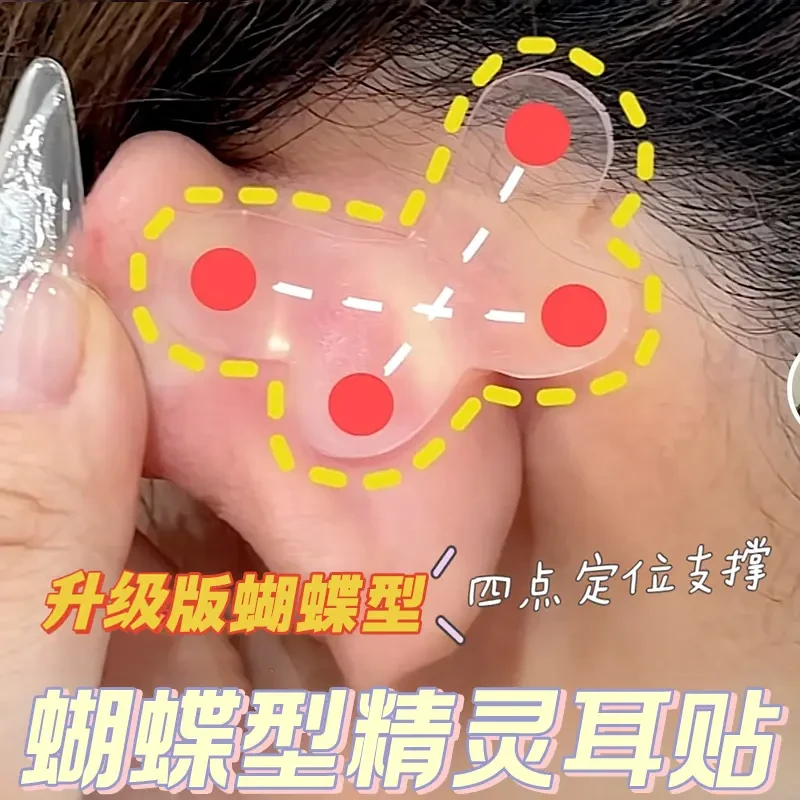 蝴蝶精灵耳贴强支撑定型亲肤女变招风耳拍照隐形大脸显小定型神器