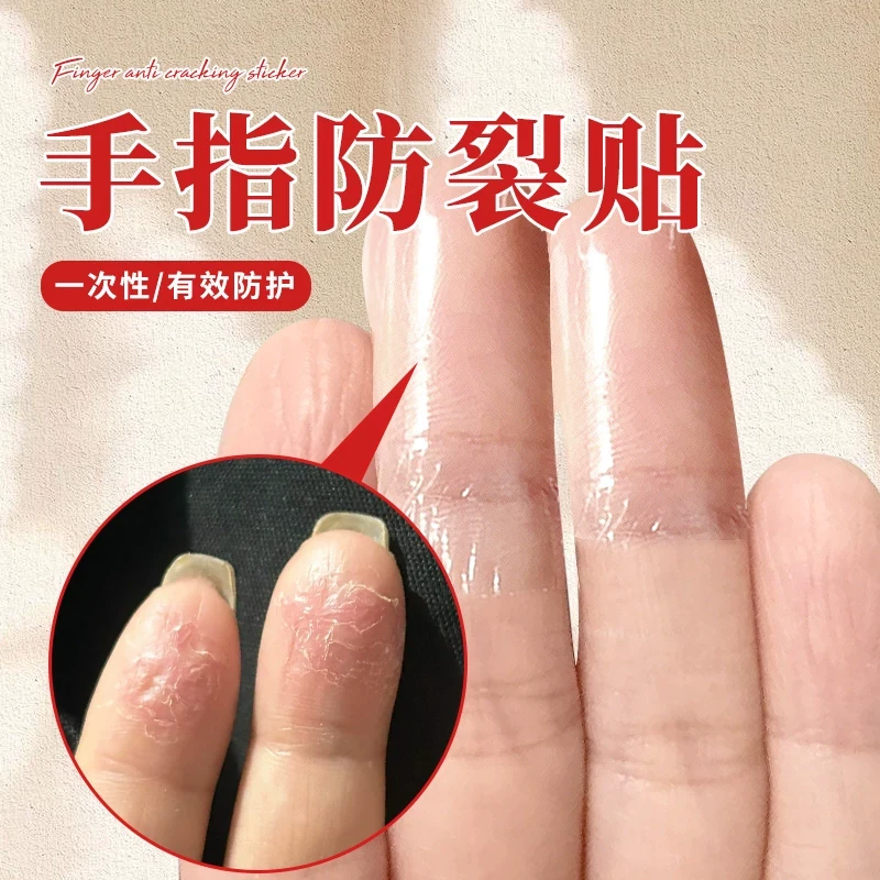 手指防裂贴防过敏手指头保护套透明防磨自粘指套防开裂防划伤