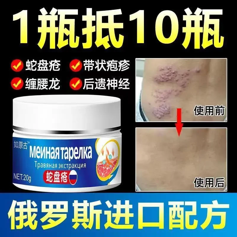 【俄罗斯配方】带状泡疹后遗症神经痛蛇盘疮膏蛇盘缠腰龙身体护理膏
