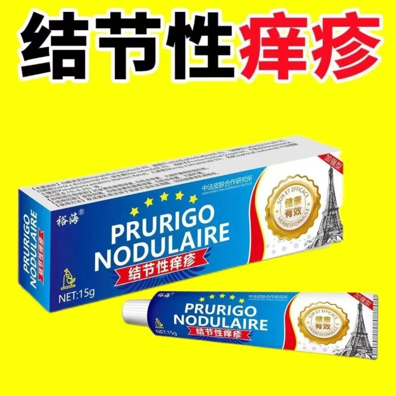 【官方正品】【结节性痒疹】胳膊腿手脚祛硬块结咔红点全身皮肤止