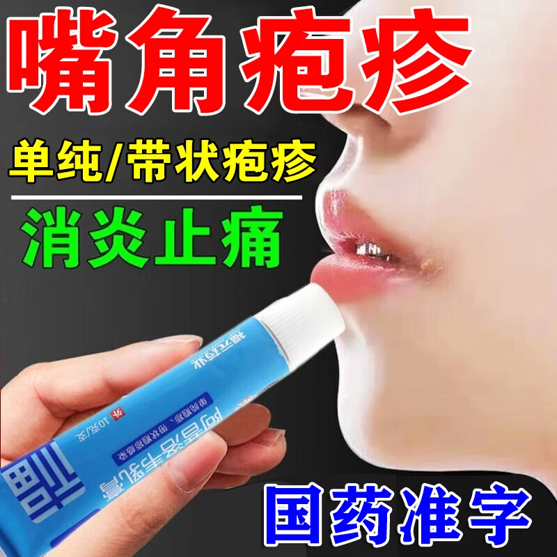 嘴角起疱疹用药 烂嘴角单纯疹或带状疹感染 疱疹嘴唇药膏 福元 阿昔洛韦乳膏 3%*10g