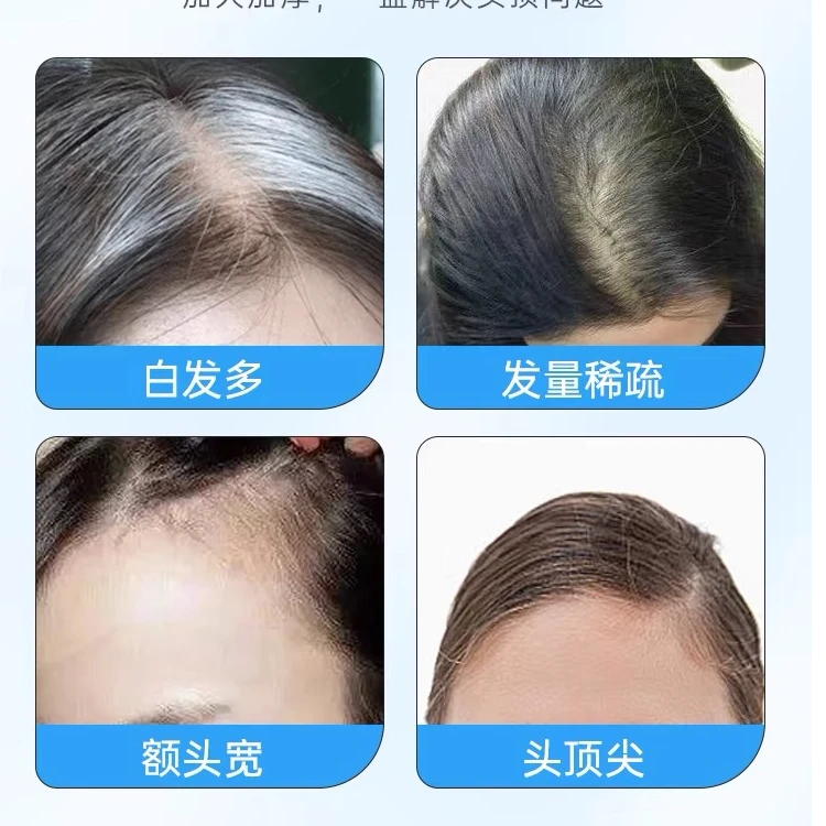 【松】孤品假发，福利，听主播讲解下单，一物一拍，全真发补发片遮白