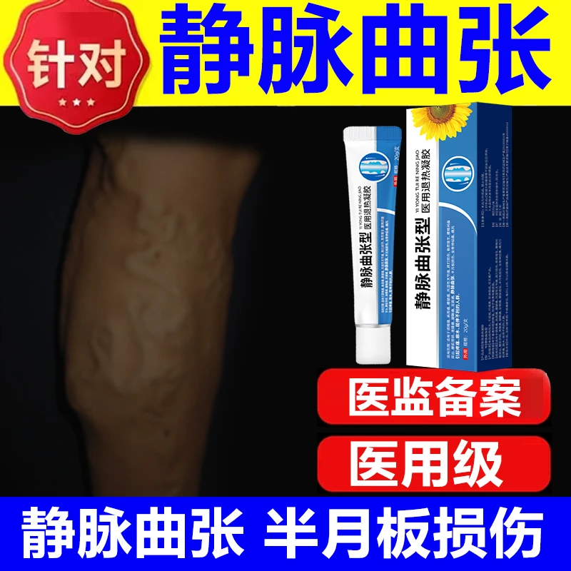 静脉曲张专用药跌打损伤半月板损伤凝胶芭菲乐医用退热凝胶