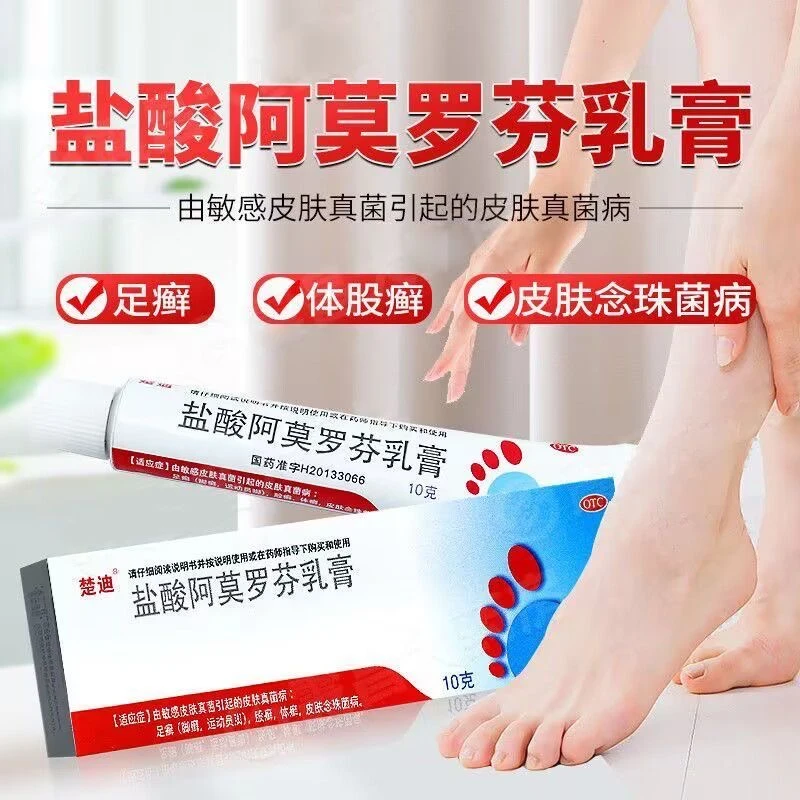 楚迪盐酸阿莫罗芬乳膏0.25%*10g治脚气药膏止痒脱皮阿莫罗芬乳膏