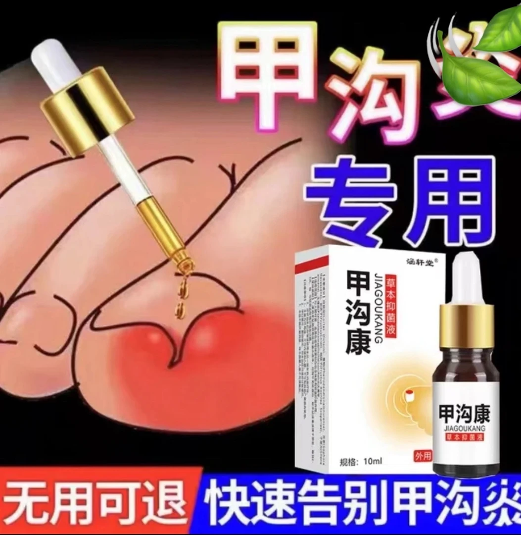 甲沟专用指甲往肉里长甲沟宁肌肤液脚趾甲手指甲男女用沟膏