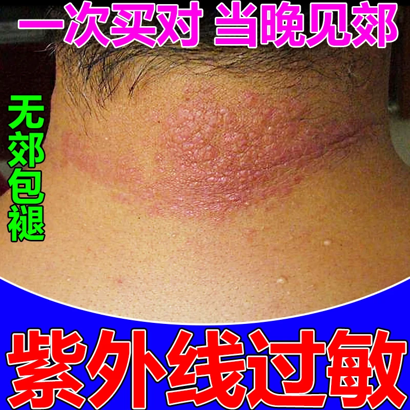 日光神经性皮肤止痒膏佰草本草抑菌乳膏肩颈全身外用涂抹快速止痒