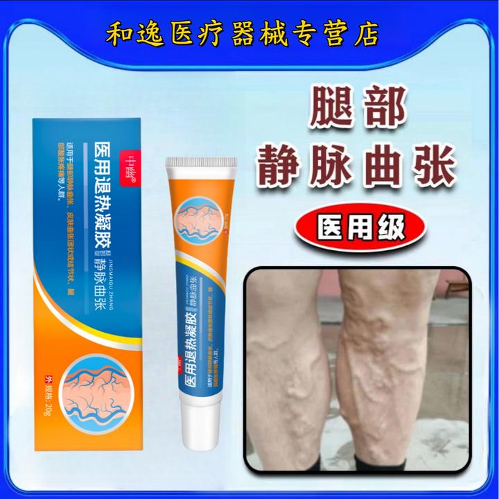 中幽医用退热凝胶静脉曲张型冷敷凝胶青筋凸起蚯蚓腿