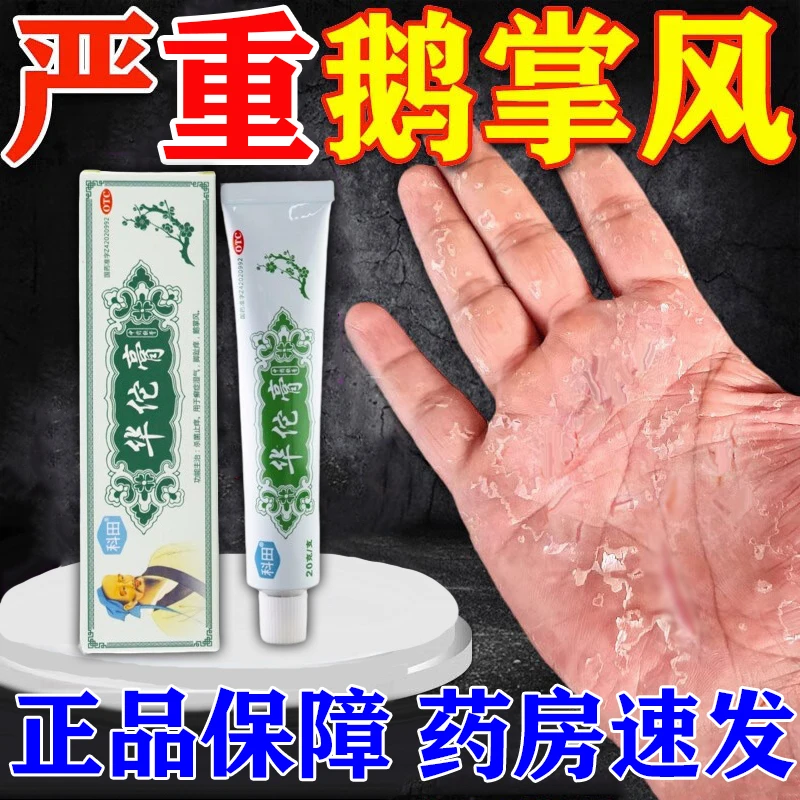 治鹅掌风药膏 手癣症皮肤真菌感染 癣症湿气脚趾痒 杀菌止痒 华佗膏 科田 20g