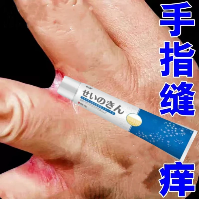 脚手指缝痒脱皮干痒碰水手指缝滥痒抑菌膏草本萃取温和无刺激软膏