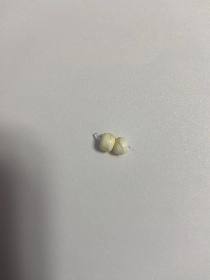 蜜蜡白蜡老型5+单珠