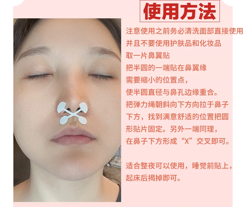 亦艾颜小哑铃弹力鼻翼贴防止鼻翼挛缩鼻孔变大白天夜间鼻孔贴矫正
