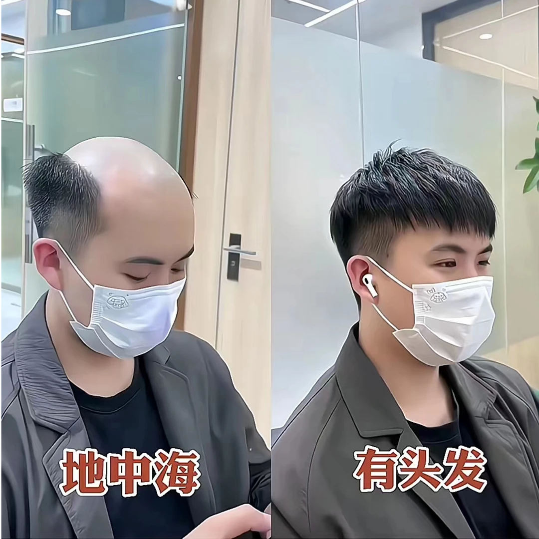 全手织 全真发 高隐形 高逼真 透气假发薄款时尚便携
