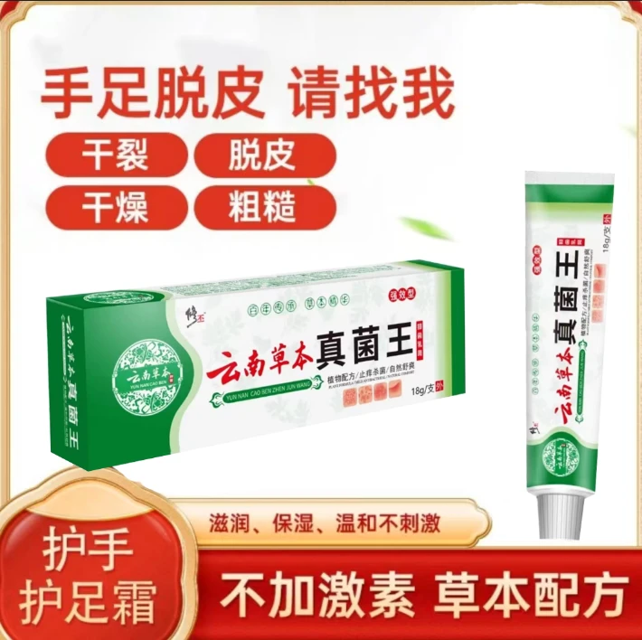 手脱皮严重脱皮专用真菌蜕皮治手干燥裂手指起皮儿童秋冬换季乳膏