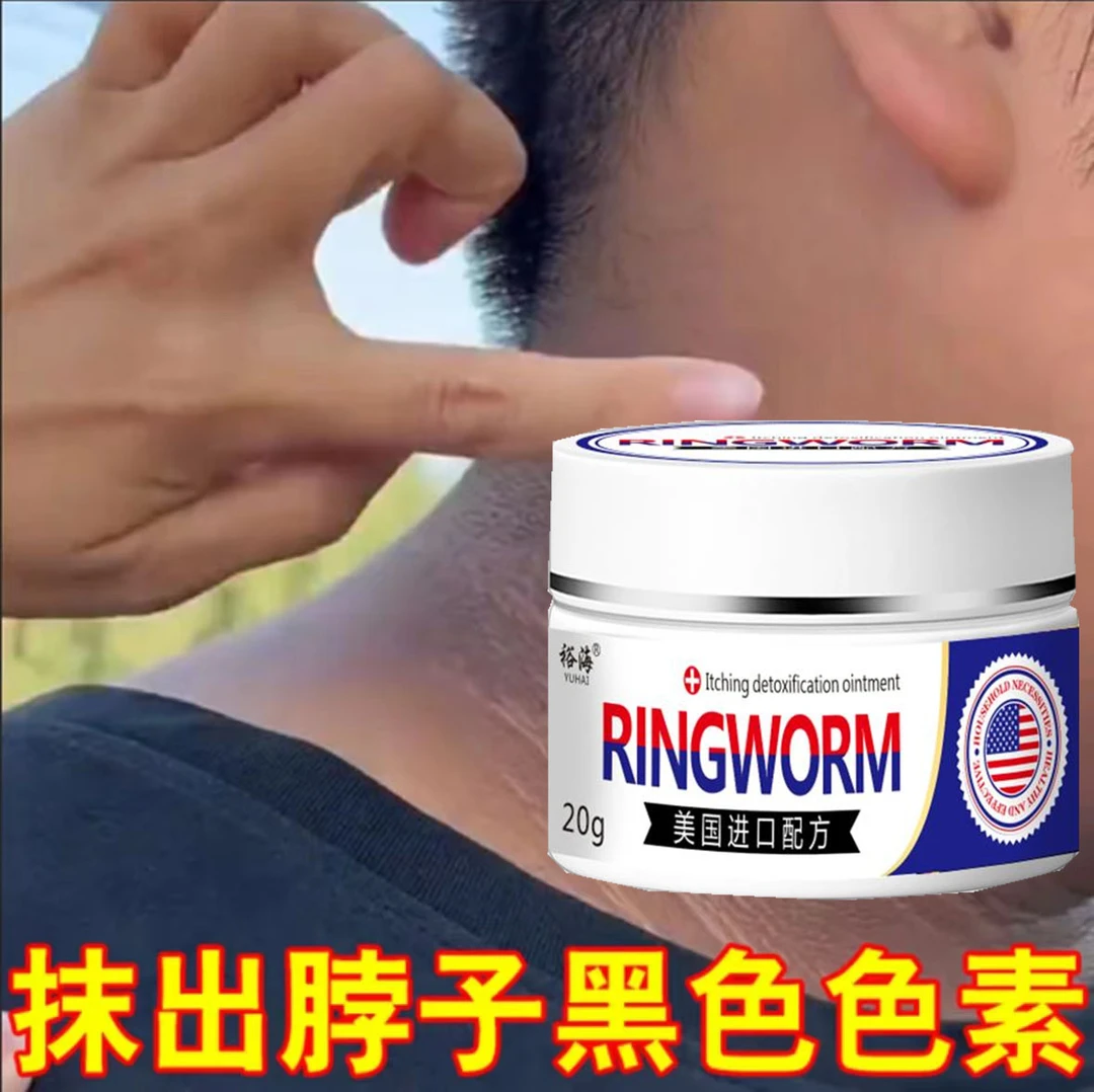 去全身嫩白黑棘皮脖子黑腋下黑大腿肩颈臀部坐印黑色素沉淀膏